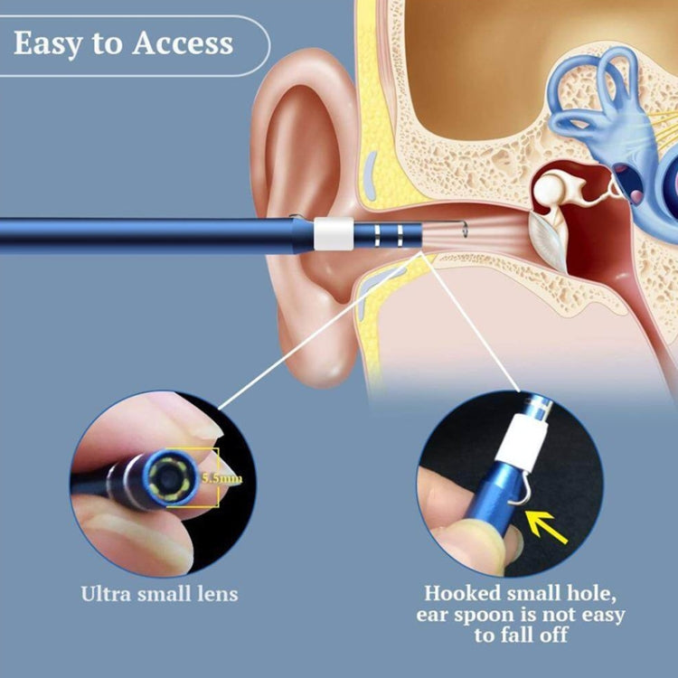 i95 3 in 1 USB Ear Scope Inspection HD 0.3MP Camera Visual Ear Spoon for OTG Android Phones & PC & MacBook, 1.75m Length Cable, 3 in 1 White  0.3MP