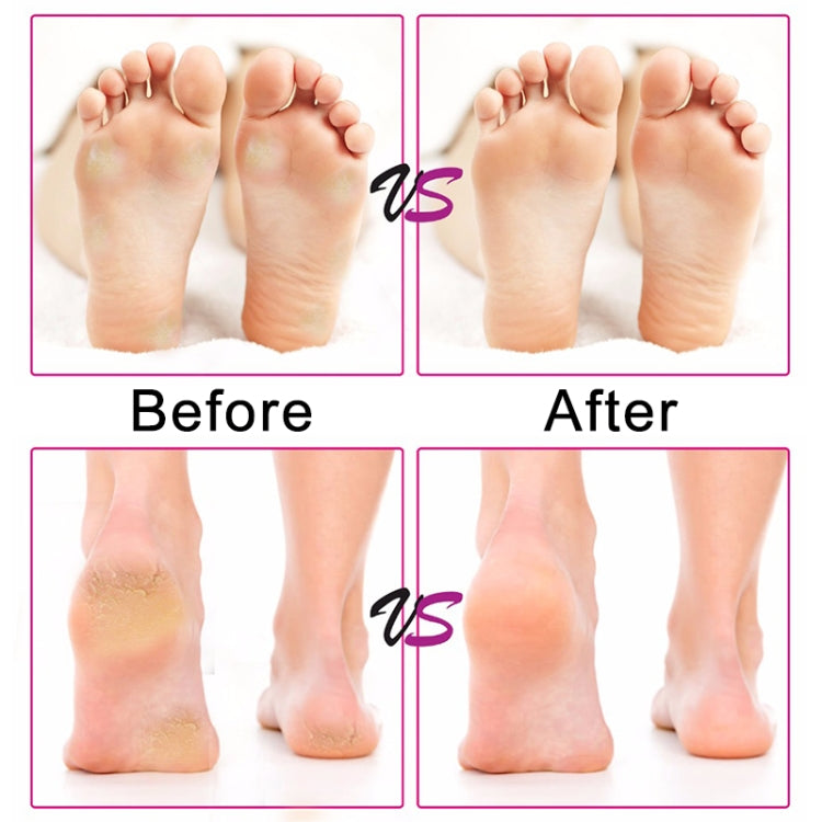 Electric Foot File Speed Adjustable Sandpaper Discs Callus Remover Pedicure Fast Remove Feet Hard Cracked Dry Dead Skin Tool, US plug, EU plug, UK plug